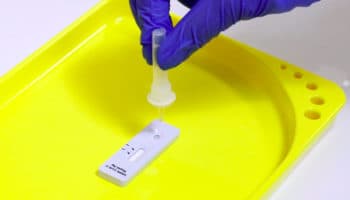 Organizadores de Juegos Olímpicos afrontan escasez de kits para pruebas Covid