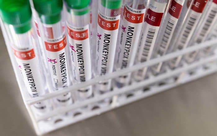 La OMS pide aumentar vigilancia por propagación de la viruela del mono