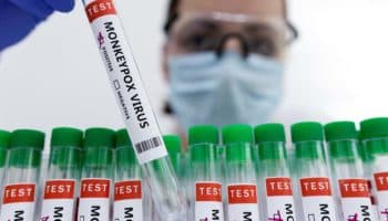 OMS se preocupa por casos de viruela del mono en niños