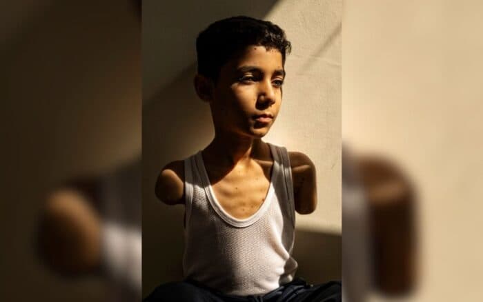 World Press Photo 2025 | Retrato de niño gazatí amputado gana Foto del Año