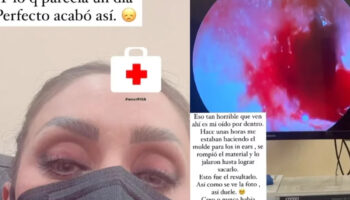 'Sigo sin oír': revela Anahí a un mes de la gira RBD