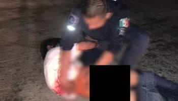 Policía de Morelos disparó contra joven; podría no volver a caminar