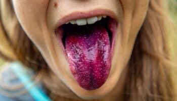 Surge evidencia de sexto gusto básico