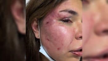 Mexicana denuncia intento de feminicidio en Colombia