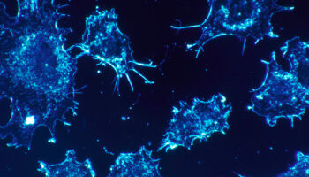 Identifican aditivo que promueve potente inmunidad frente al cáncer