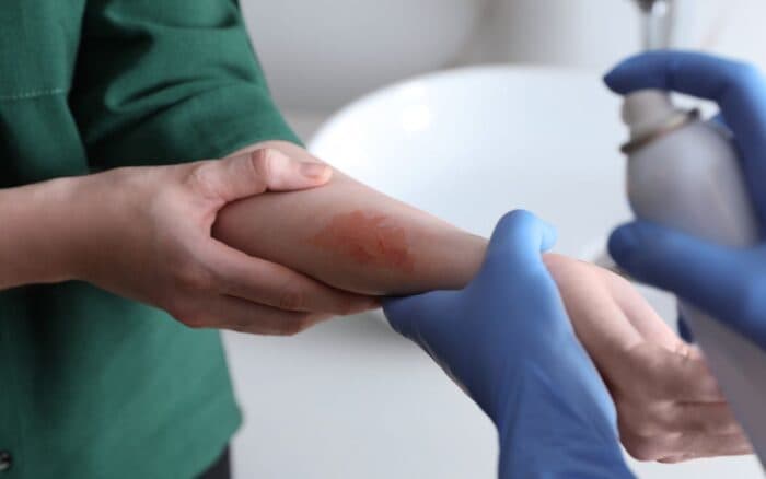 La piel: un reflejo del estrés psicológico