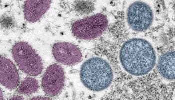 El 75% de las enfermedades infecciosas emergentes son transmitidas a los humanos por animales: especialista