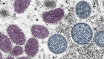 El 75% de las enfermedades infecciosas emergentes son transmitidas a los humanos por animales: especialista