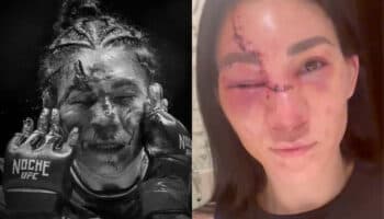 'Otro día en la oficina': Irene Aldana ya se recupera tras corte en pelea de UFC