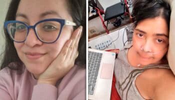 'El Covid no fue, no es y no será jamás una gripe fuerte': a 5 años de la pandemia, Emilia y Zaria viven con Covid persistente