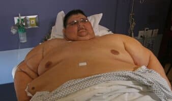 Muere Juan Pedro Franco, mexicano conocido por haber sido el hombre más obeso del mundo